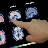 La société vaudoise AC Immune doit couper dans ses effectifs (photo d'illustration). KEYSTONE/AP/MATT YORK