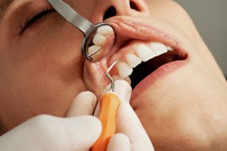 Les dentistes valaisans réagissent aux publicités pour des cliniques à l'étranger (image d'illustration)