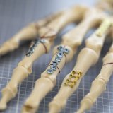 La commission européenne a rappelé l'Allemagne à l'ordre sur la question des dispositifs médicaux suisses (photo d'illustration).