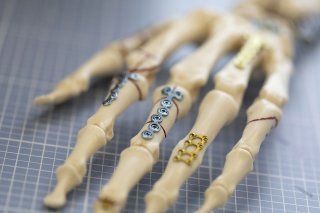 La commission européenne a rappelé l'Allemagne à l'ordre sur la question des dispositifs médicaux suisses (photo d'illustration).