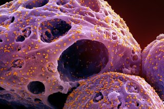 Tandis que notre protection contre les maladies infectieuses a augmenté depuis l'âge du bronze, ces mêmes mutations nous ont rendus plus vulnérables aux maladies auto-immunes et inflammatoires, selon une étude (image symbolique).